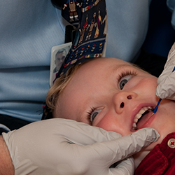 Child getting a fluoride varnish